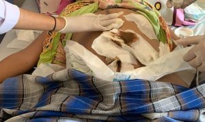 Oknum Salah Satu Dokter Ahli Penyakit Dalam dan Bedah (ER,S) di RS Bhayangkara Makassar Diduga Lakukan Malpraktek